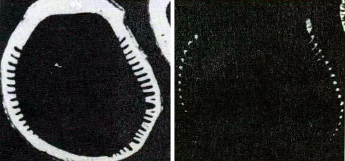 Чередование L-CAM и N-CAM в ходе развития бородковых валиков. Здесь представлены поперечные срезы развивающегося перьевого фолликула, окрашенные флуоресцентными антителами против L-CAM (слева) или же N-CAM (справа). L-CAM соединяют клетки валиков, а N-CAM-клетки, расположенные между валиками. Вскоре после этой стадии в клетках, продуцирующих L-CAM, образуется фибриллярный белок кератин, а клетки с N-CAM отмирают